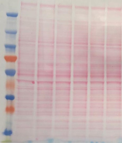 prestained-protein-ladder-ideal-to-track-protein-bands-of-10-250-kda-in